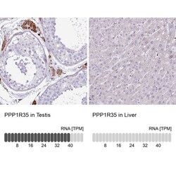 PPP1R35 Antibody, Novus Biologicals 0.1mL; Unlabeled:Antibodies, Polyclonal